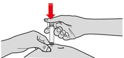 Figure 4 (Pic4   Henlius   Step For Ifu)